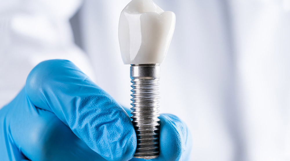 Dental implant with a white crown held by a gloved hand in a dental setting.
